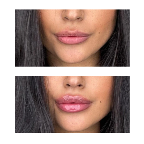Lisa V. review foto
